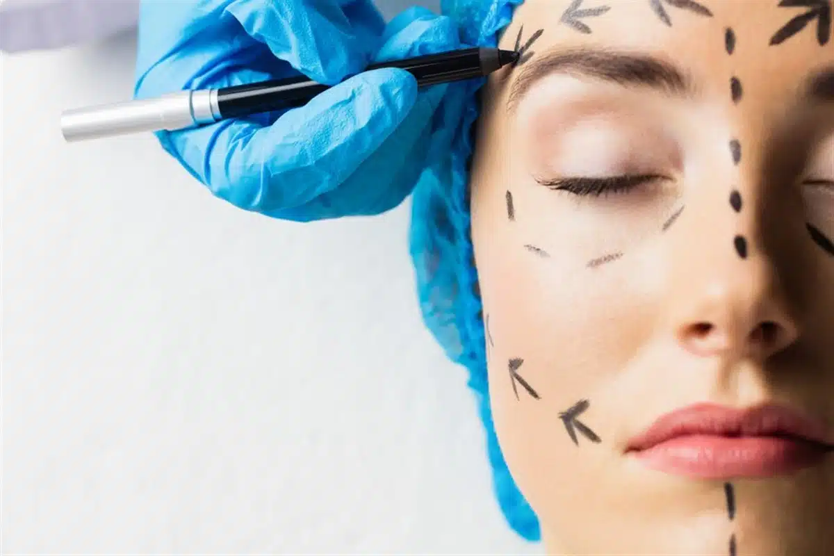 chirurgie esthétique